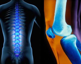 Лечение ревматизма