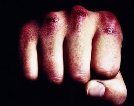 Под Кыштымом женщина избила ребенка, за то, что он не так поздоровался