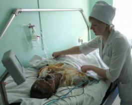 В больнице умер мальчик, обгоревший на костре в Миассе