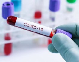 В Челябинской области за минувшие сутки 91 человек заболел коронавирусом